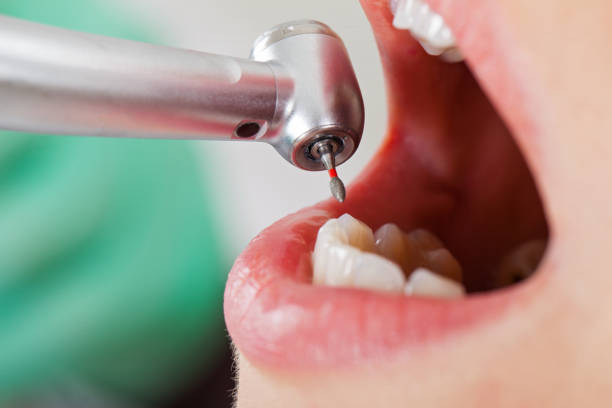 Best Emergency Treatment for Dental Infections or Abscesses in Greenfield, TN